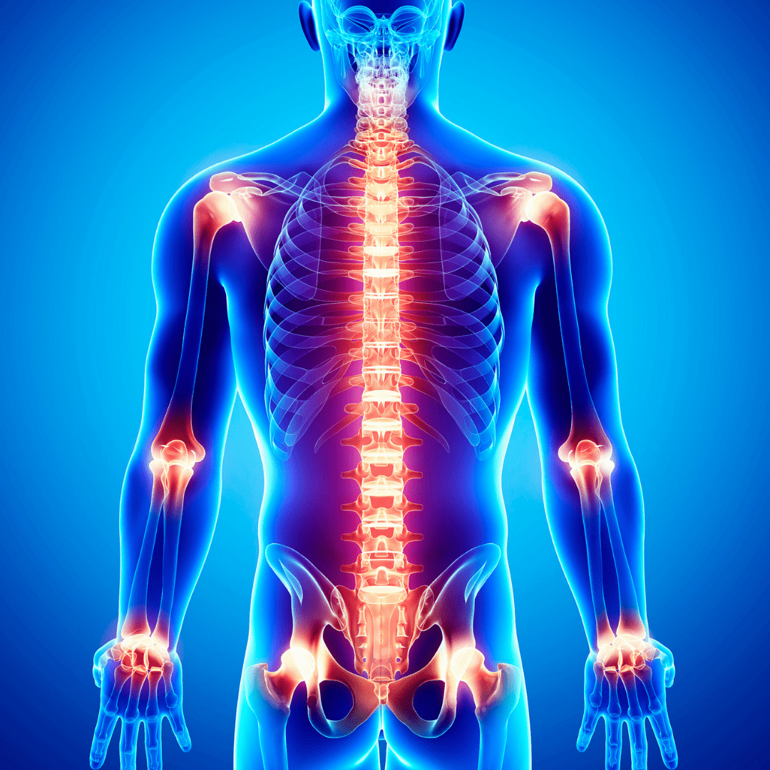 Chiropractic Care for Arthritis Relief in Mesa, AZ